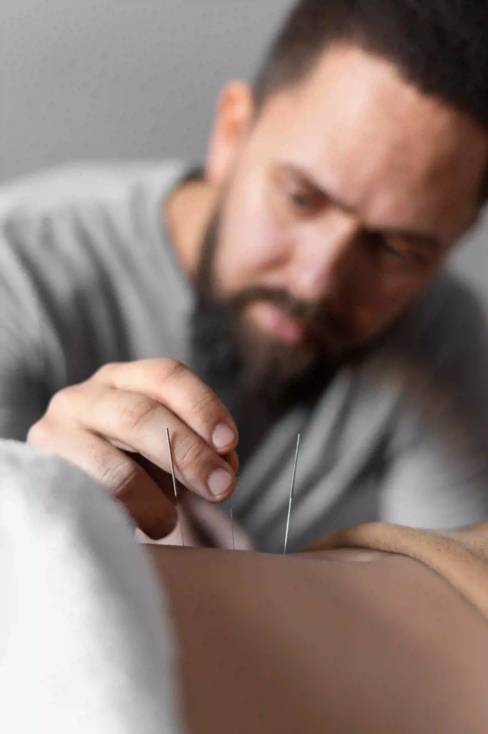 dry needling near me